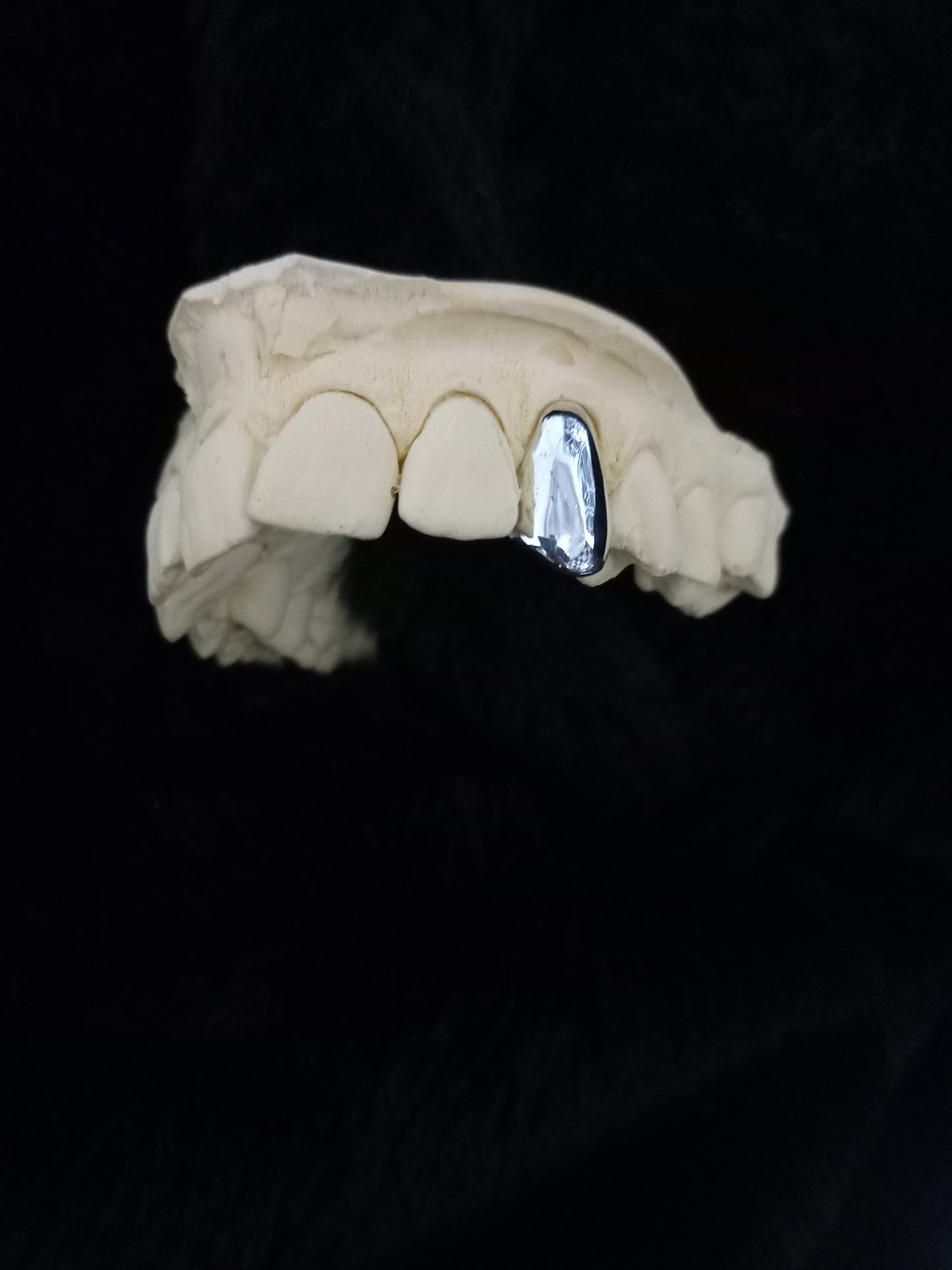 Single silver cap