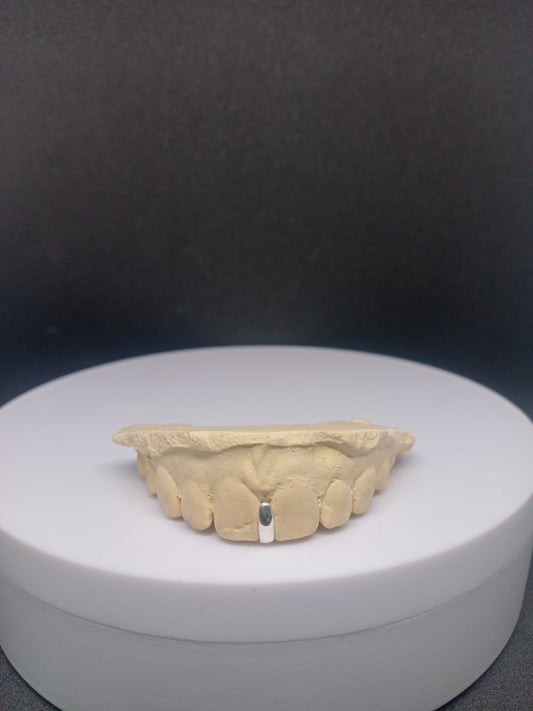 Custom made 925 silver gap filler grillz